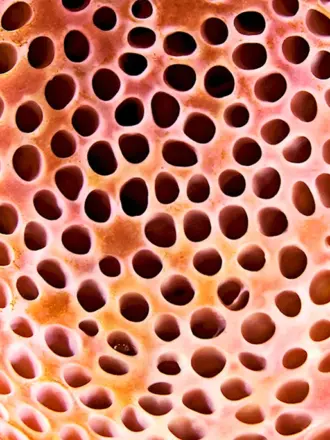 Песчаная блоха трипофобия